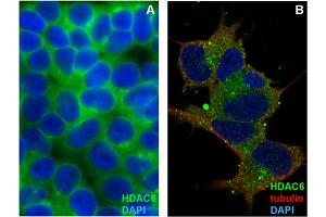 Immunocytochemistry (ICC) image for anti-Histone Deacetylase 6 (HDAC6) antibody (ABIN7013926)