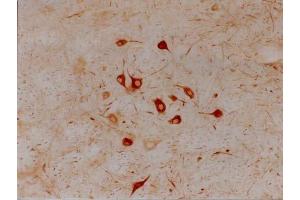 Section of adult rat brain stem showing facial nucleus 3 days after lesion of the contralateral facial nerve. (INA antibody)
