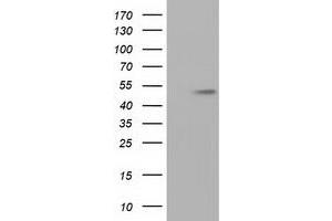 Western Blotting (WB) image for anti-Tubulin, alpha 8 (TUBA8) antibody (ABIN1501559)