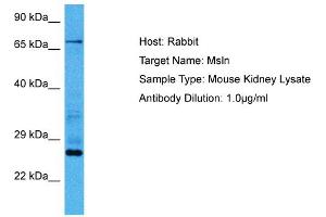 Host:  Mouse  Target Name:  MSLN  Sample Tissue:  Mouse Kidney  Antibody Dilution:  1ug/ml (Mesothelin antibody  (Middle Region))