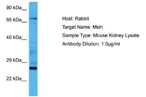Host:  Mouse  Target Name:  MSLN  Sample Tissue:  Mouse Kidney  Antibody Dilution:  1ug/ml (Mesothelin antibody  (Middle Region))