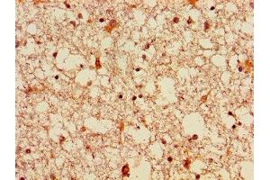 Immunohistochemistry of paraffin-embedded human brain tissue using ABIN7152811 at dilution of 1:100