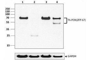 Western Blotting (WB) image for anti-Th-POK antibody (ABIN2665409) (Th-POK antibody)