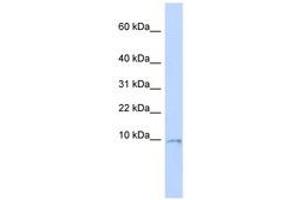 Image no. 1 for anti-Ubiquinol-Cytochrome C Reductase, Complex III Subunit X (UQCR10) (C-Term) antibody (ABIN6740874) (UQCR10 antibody  (C-Term))