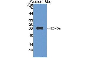 Western Blotting (WB) image for anti-Matrix Metallopeptidase 12 (Macrophage Elastase) (MMP12) (AA 294-473) antibody (ABIN1172854) (MMP12 antibody  (AA 294-473))