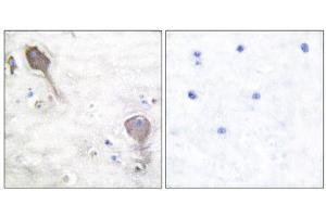 Immunohistochemistry (IHC) image for anti-Parkinson Protein 2, E3 Ubiquitin Protein Ligase (Parkin) (PARK2) (N-Term) antibody (ABIN1848726)