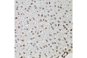Immunohistochemistry of paraffin-embedded mouse liver using KDM4A antibody (ABIN6131821, ABIN6142793, ABIN6142795 and ABIN6223960) at dilution of 1:100 (40x lens). (KDM4A antibody  (AA 585-815))