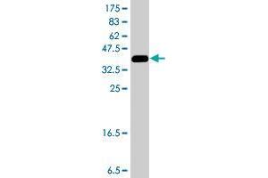 Western Blot detection against Immunogen (37 KDa) . (CNKSR3 antibody  (AA 366-464))