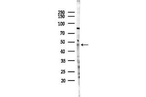 anti-Zinc Finger and BTB Domain Containing 32 (ZBTB32) antibody
