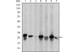 HSP27 antibody