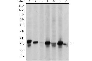 Western blot analysis using HSP27 mouse mAb against Hela (1), A549 (2), Jurkat (3), A431 (4), HEK293(5), HepG2 (6) and PC-12 (7) cell lysate.