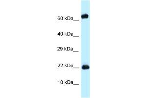WB Suggested Anti-Zfp580 Antibody Titration: 1. (ZNF580 antibody  (Middle Region))