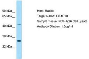 Image no. 1 for anti-Eukaryotic Translation Initiation Factor 4E Family Member 1B (EIF4E1B) (AA 114-163) antibody (ABIN6749878) (EIF4E1B antibody  (AA 114-163))