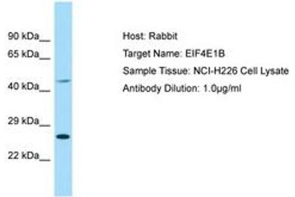 EIF4E1B antibody  (AA 114-163)