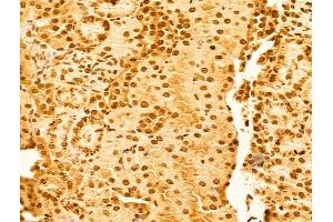 ABIN6263918 and ABIN6273062 at 1/100 staining Rat kidney tissue by IHC-P. (OTUD7B antibody  (C-Term))