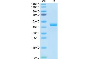 Human CCL24 on Tris-Bis PAGE under reduced condition. (CCL24 Protein (AA 27-119) (Fc Tag))