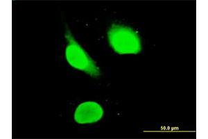 Immunofluorescence of monoclonal antibody to IKZF3 on HeLa cell. (IKZF3 antibody  (AA 1-509))