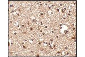 Immunohistochemistry of JPH4 in human brain tissue with this product at 2.