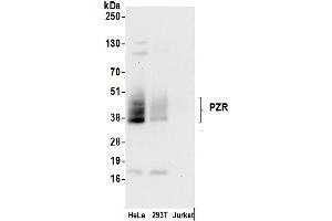 anti-Myelin Protein Zero-Like 1 (MPZL1) (AA 225-275) antibody