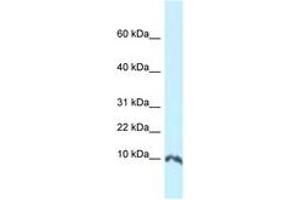 Image no. 1 for anti-Small Ubiquitin Related Modifier Protein 1 (SUMO1) (N-Term) antibody (ABIN6747653)