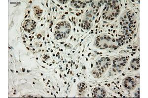 Immunohistochemical staining of paraffin-embedded breast tissue using anti-L1CAM mouse monoclonal antibody.