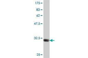 Western Blot detection against Immunogen (33. (GBA3 antibody  (AA 402-468))