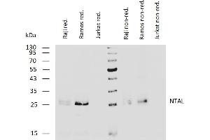 Western blotting analysis of human NTAL using mouse monoclonal antibody NAP-07 on lysates of Raji and Ramos cells and on Jurkat cells (negative control) under reducing and non-reducing conditions.