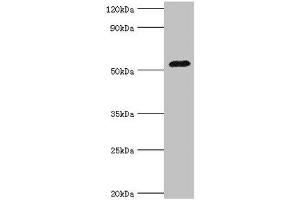 Western blot All lanes: Angiotensinogen antibody at 3 μg/mL + Mouse liver tissue Secondary Goat polyclonal to rabbit IgG at 1/10000 dilution Predicted band size: 53 kDa Observed band size: 53 kDa (AGT antibody  (AA 35-285))