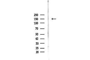 anti-Tuberous Sclerosis 1 (TSC1) (C-Term) antibody