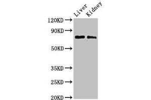 Western Blot Positive WB detected in: Mouse liver tissue, Mouse kidney tissue All lanes: PHF21A antibody at 3 μg/mL Secondary Goat polyclonal to rabbit IgG at 1/50000 dilution Predicted band size: 75, 71 kDa Observed band size: 75 kDa (PHF21A antibody  (AA 312-487))