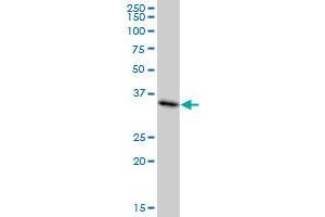 MDH1 monoclonal antibody (M01), clone 2B11-B7. (MDH1 antibody  (AA 1-334))