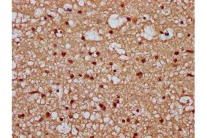 IHC image of ABIN7171666 diluted at 1:300 and staining in paraffin-embedded human brain tissue performed on a Leica BondTM system. (Tiparp antibody  (AA 74-178))