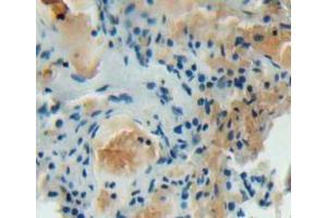 IHC-P analysis of lung tissue, with DAB staining. (DOCK2 antibody  (AA 390-635))