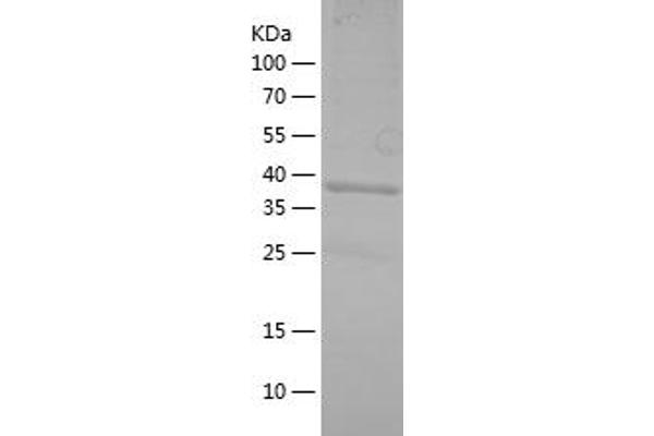 ARR3 Protein (AA 87-213) (His-IF2DI Tag)