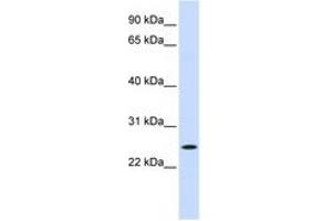Image no. 1 for anti-Nucleolar Protein 3 (Apoptosis Repressor with CARD Domain) (NOL3) (C-Term) antibody (ABIN6744368)