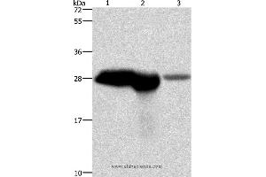 Western blot analysis of Mouse brain and kidney tissue, human fetal brain tissue, using CALB1 Polyclonal Antibody at dilution of 1:750 (CALB1 antibody)