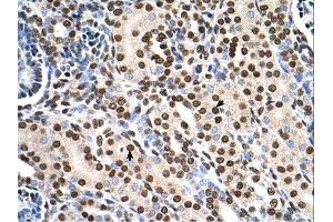 Immunohistochemistry (IHC) image for anti-Ras Suppressor Protein 1 (RSU1) (C-Term) antibody (ABIN2783331) (RSU1 antibody  (C-Term))