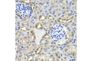 Immunohistochemistry of paraffin-embedded mouse kidney using DEDD antibody (ABIN5973422) at dilution of 1/100 (40x lens).