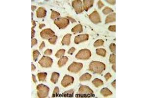 Immunohistochemistry (IHC) image for anti-Protein tyrosine Phosphatase, Non-Receptor Type 11 (PTPN11) antibody (ABIN3002836)