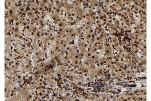 ABIN6272981 at 1/100 staining Human liver tissue by IHC-P. (SULT1E1 antibody  (Internal Region))