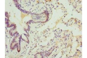Immunohistochemistry of paraffin-embedded human lung tissue using ABIN7144880 at dilution of 1:100 (ABCA3 antibody  (AA 43-203))