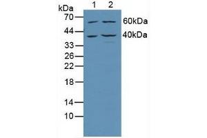Western blot analysis of (1) Human Jurkat Cells and (2) Human HeLa cells. (TRADD antibody  (AA 61-297))
