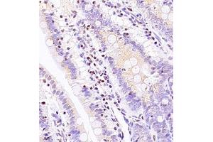 Immunohistochemistry of paraffin embedded rat ileum using ASBT (ABIN7075648) at dilution of 1:1500 (400x lens) (SLC10A2 antibody)