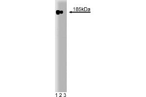 Western Blotting (WB) image for anti-Receptor tyrosine-protein kinase erbB-2 (ErbB2/Her2) (AA 182-373) antibody (ABIN967787) (ErbB2/Her2 antibody  (AA 182-373))