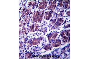 CCDC22 Antibody (C-term) (ABIN657403 and ABIN2846443) immunohistochemistry analysis in formalin fixed and paraffin embedded human stomach tissue followed by peroxidase conjugation of the secondary antibody and DAB staining. (CCDC22 antibody  (C-Term))