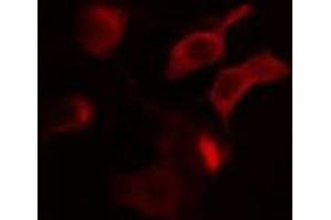 ABIN6275002 staining MCF7 cells by IF/ICC. (CLCN4 antibody  (Internal Region))