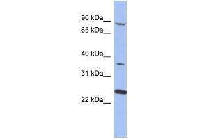 WB Suggested Anti-MPP3 Antibody Titration: 0. (MPP3 antibody  (N-Term))