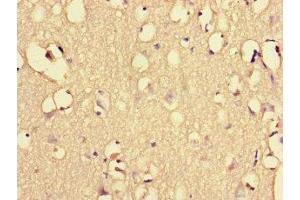 Immunohistochemistry of paraffin-embedded human brain tissue using ABIN7151461 at dilution of 1:100 (EHD3 antibody  (AA 269-498))