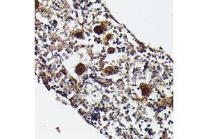 Immunohistochemistry of paraffin-embedded rat bone marrow using CXCL4/PF4 Rabbit pAb (ABIN7269400) at dilution of 1:50 (40x lens).