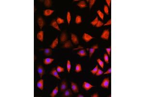 Immunofluorescence analysis of L929 cells using KIF Rabbit pAb (ABIN1680591, ABIN3019005, ABIN3019006 and ABIN6220670) at dilution of 1:100. (KIFAP3 antibody  (AA 1-200))
